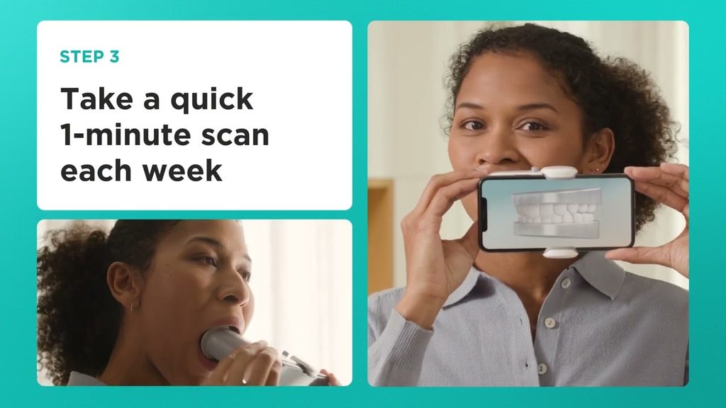 Dental Monitoring video: take a quick scan of your teeth at home with your smartphone